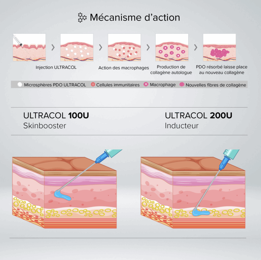 ultracol lille injectionn acide hyaluronique docteur delaoustre