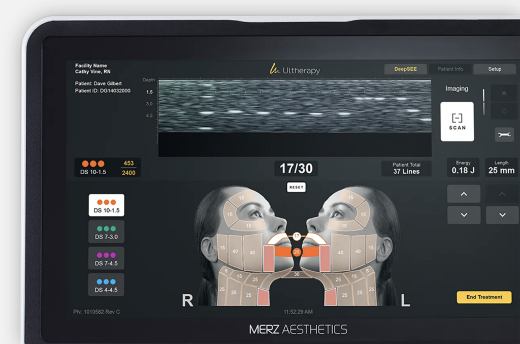 Ulthera lille docteur delaoustre médecin esthétique lille hifu